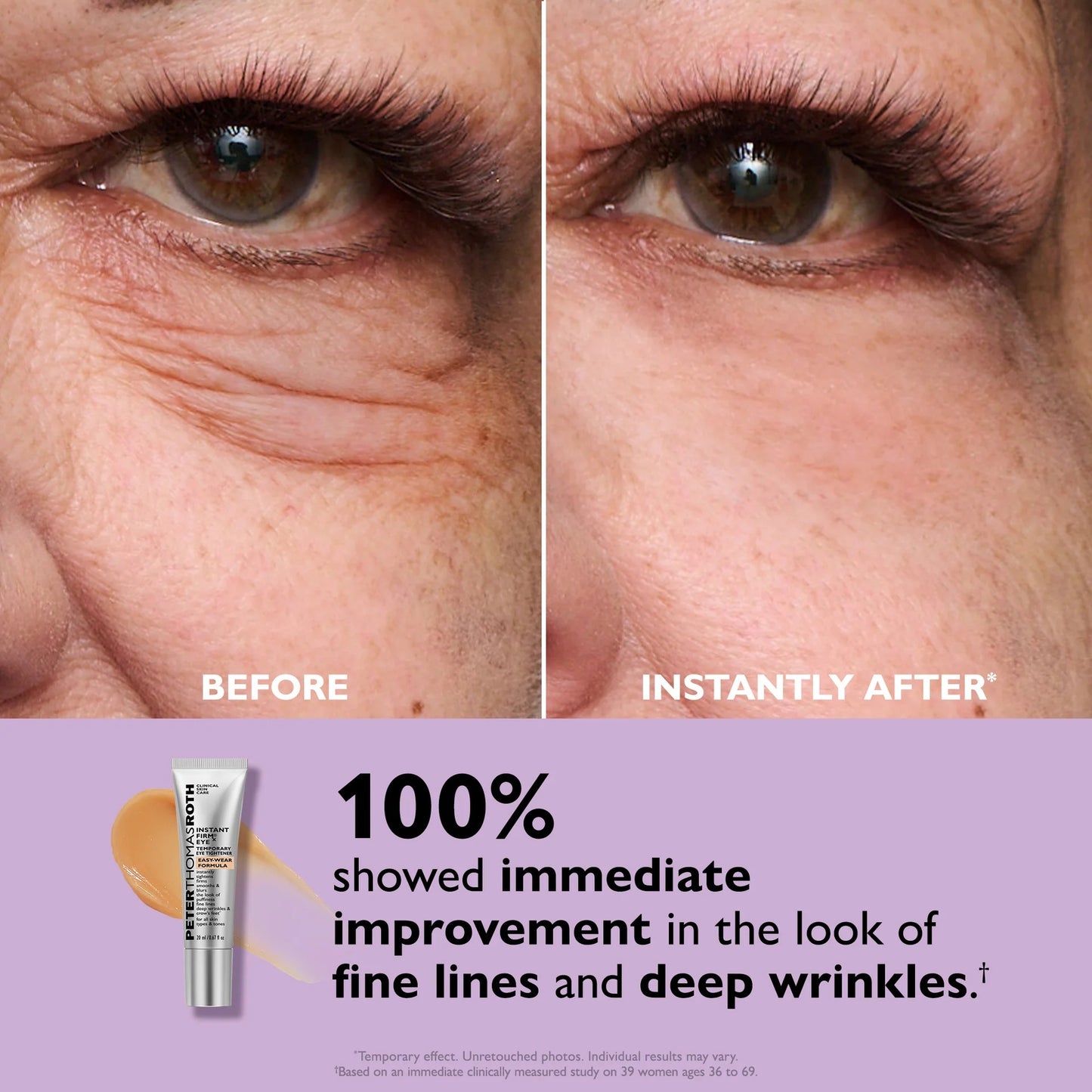 Peter Thomas Roth | Instant FIRMx® Eye Temporary Eye Tightener Easy-Wear Formula | For Firming Under-Eye Bags & Wrinkles